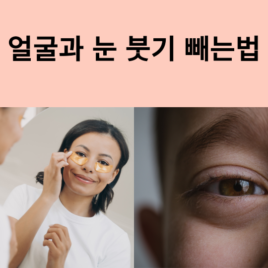 얼굴과 눈 붓기 빼는 법, 차나 약이 도움이 될까?
