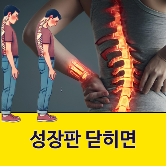 성장판 닫히면 더 이상 키는 못 크나요?