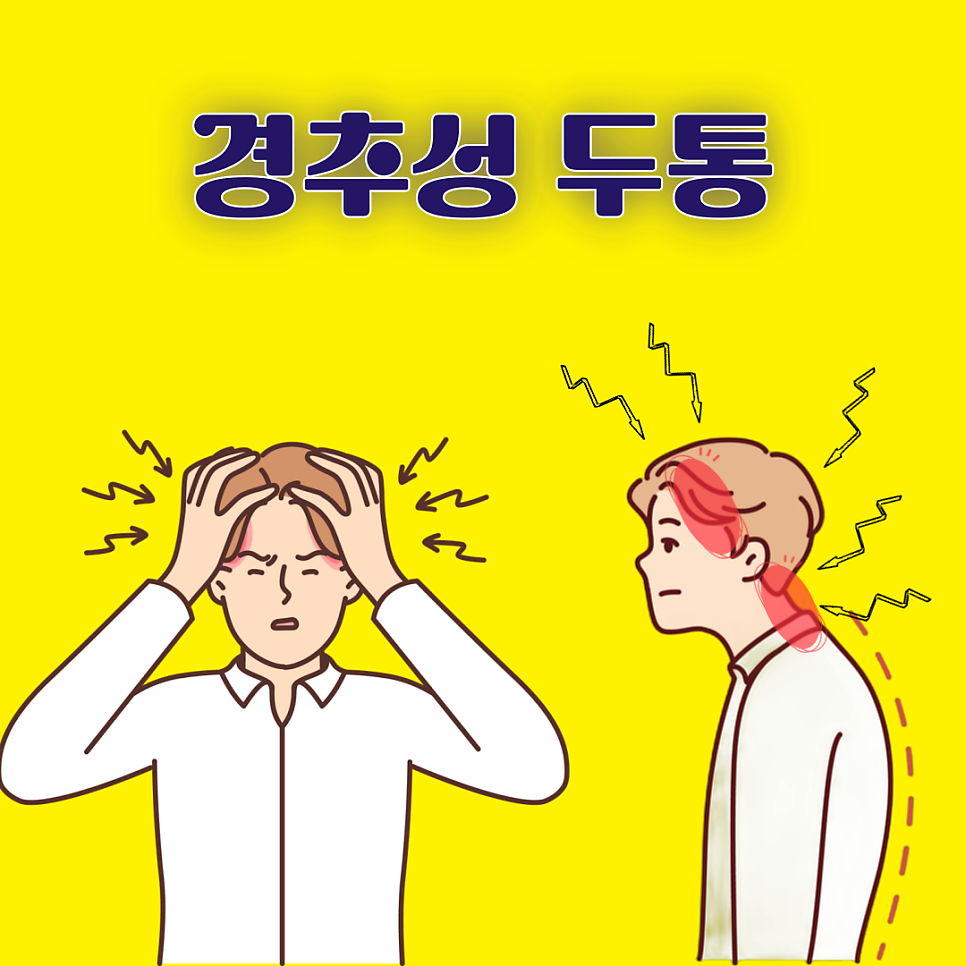 머리 경추성 두통 병원이 알려드리는 원인과 관리법