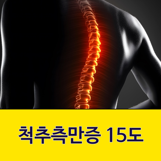 척추측만증 15도는 성장에 영향을 줄까?
