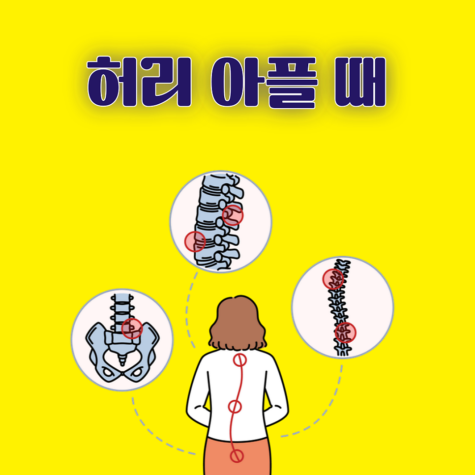 허리 아플 때 약이나 파스 이외의 방법은?