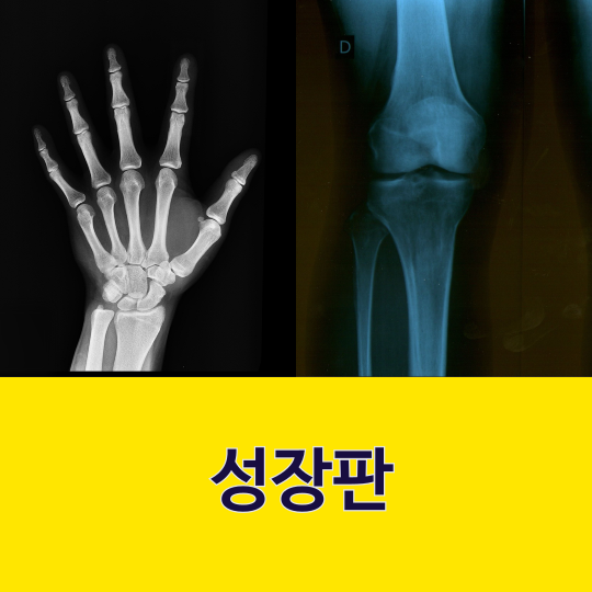 성장판 자가진단과 검사 방법은?