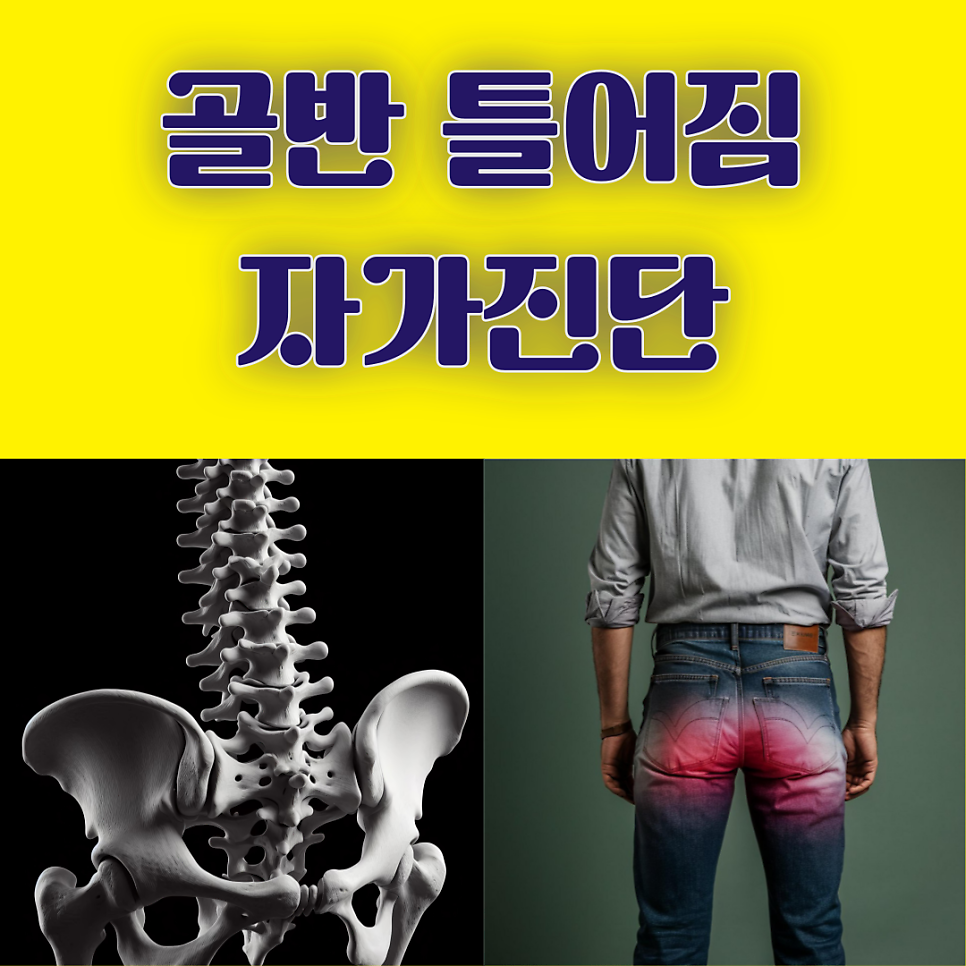 오른쪽, 왼쪽 골반 틀어짐 자가 진단 방법