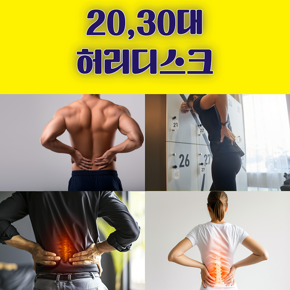 20, 30대 허리디스크 어떻게 관리해야 할까?